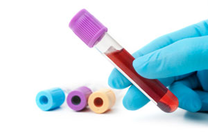 laboratory Blood Work